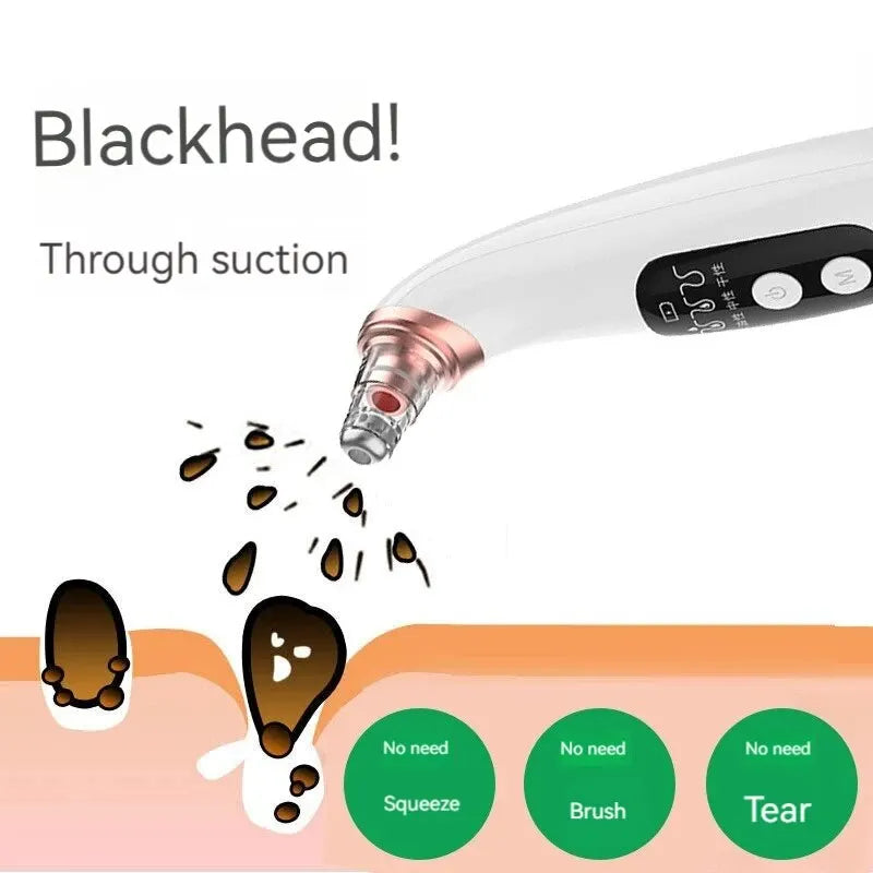 Blackhead Remover Vacuum Acne Cleaner Black Spots Removal